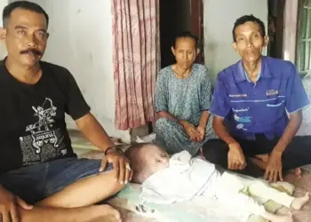 Bayi Mengidap Hidrosefalus, Butuhkan Bantuan