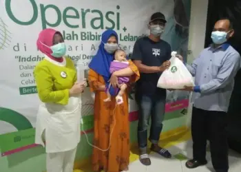 Peringati Hari Anak RS Sari Asih Serang Operasi Gratis Bibir Sumbing