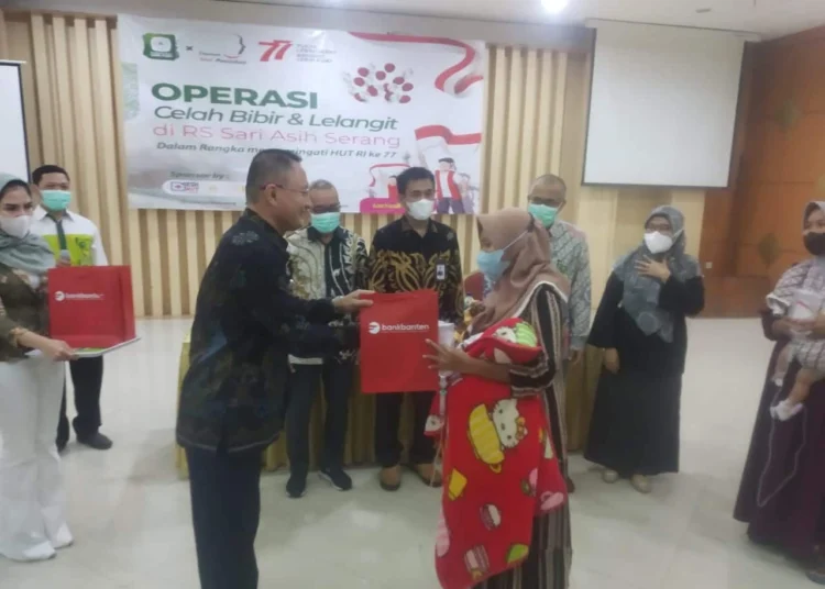 Bank Banten dan RS Sari Asih, kolaborasi tangani penderita bibir sumbing, Kamis (LUTHFI/SATELITNEWS.ID)