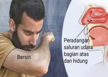 Musim Penghujan, Warga Lebak Diminta Waspadai ISPA