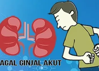 Kasus Gagal Ginjal Akut Kembali Ditemukan di Jakarta, 1 Anak Meninggal