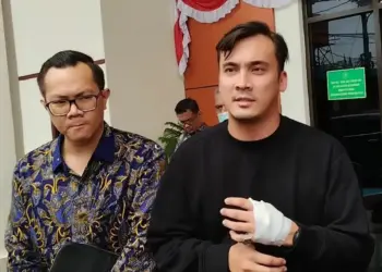 Rendy Kjaernett Ungkap Kronologi Kecelakaan di Tol Bareng Lady Nayoan