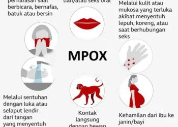 Simak ya, Ini Perbedaan Mpox vs Covid-19 !